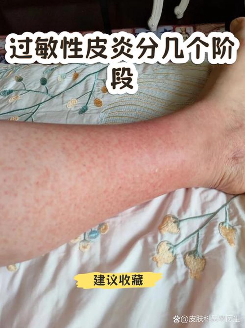 探索皮肤专科门诊：专业的诊断与治疗
