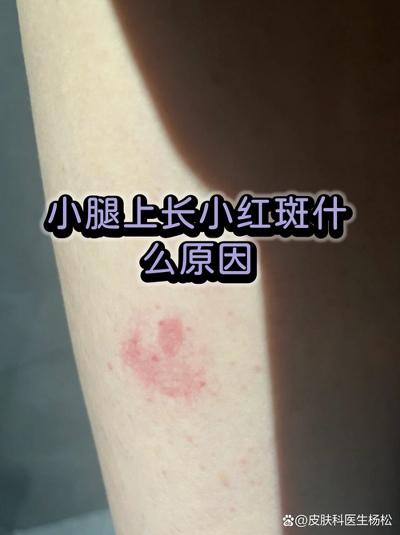 如何选择适合自己的皮肤科？以绵阳为例