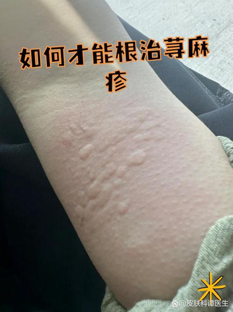皮肤过敏