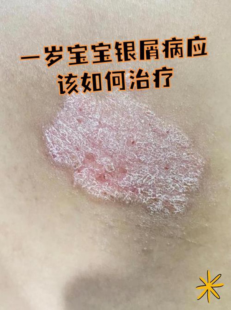 选择皮肤专科门诊的明智指南