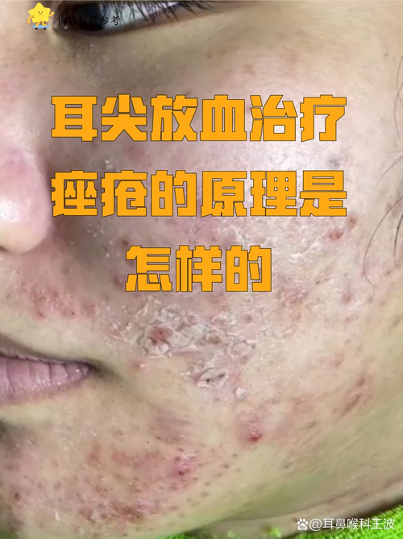 警惕皮肤专科门诊的几个误区