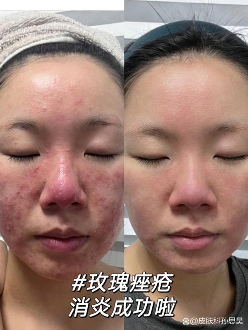 绵阳皮肤科：美丽与健康的守护者