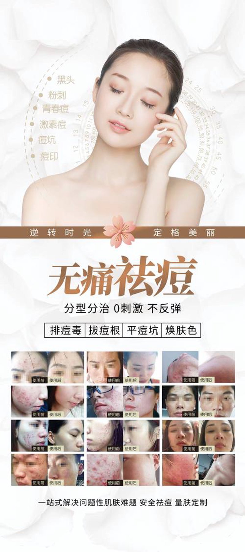 湿疹治疗选购指南：寻找适合的治疗方法