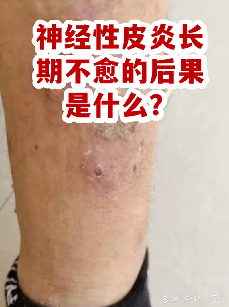 打造完美肌肤：皮肤专科门诊的使用技巧